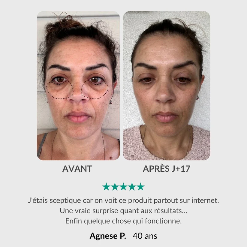 Soin Intégral du Regard : Stylo & Sérum Activateur