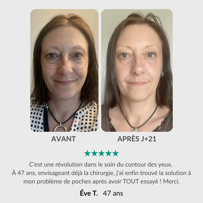 Soin Intégral du Regard : Stylo & Sérum Activateur