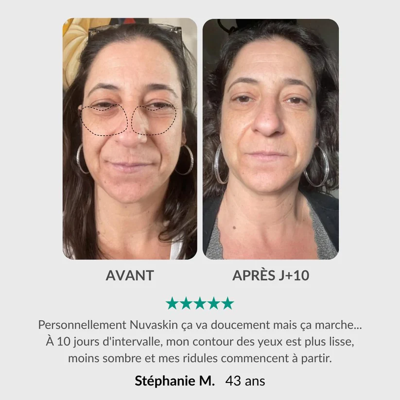 Soin Intégral du Regard : Stylo & Sérum Activateur