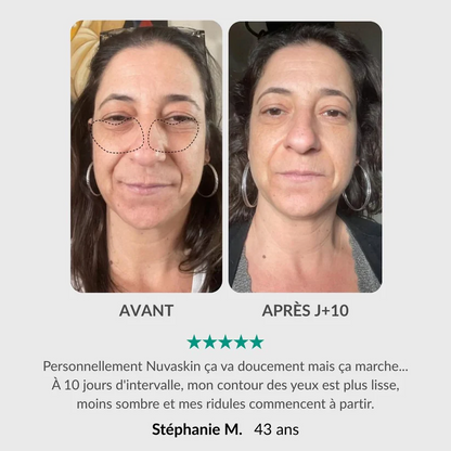 Soin Intégral du Regard : Stylo & Sérum Activateur